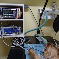 Monitoring pacienta počas operácie